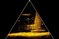 Echosonda LOWRANCE EYE 9 LIVE - 3